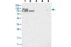 Western blot analysis of Lane 1: RT-4, Lane 2: U-251 MG, Lane 3: Human Plasma, Lane 4: Liver, Lane 5: Tonsil with LARP5 polyclonal antibody  at 1:250-1:500 dilution.