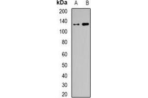 Western blot analysis of BAF155 expression in SW620 (A), HEK293T (B) whole cell lysates. (SMARCC1 anticorps)