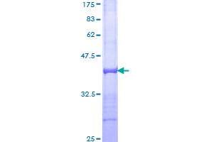 Image no. 1 for Sortilin-Related Receptor, L(DLR Class) A Repeats Containing (SORL1) (AA 82-181) protein (GST tag) (ABIN1320969)