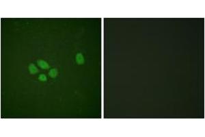 Immunofluorescence analysis of A549 cells, using SOX-9 (Phospho-Ser181) Antibody. (SOX9 anticorps  (pSer181))