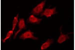ABIN6274225 staining Hela by IF/ICC. (LTK anticorps  (Internal Region))