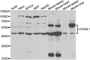 Western blot analysis of extracts of various cell lines, using CDKAL1 antibody. (CDKAL1 anticorps)