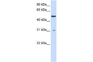 WB Suggested Anti-AGXT2L2 Antibody Titration:  0. (AGXT2L2 anticorps  (N-Term))