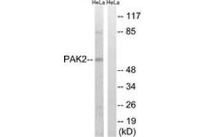 Western blot analysis of extracts from HeLa cells, treated with TSA 400nM 24H, using PAK2 (Ab-141) Antibody. (PAK2 anticorps  (AA 107-156))