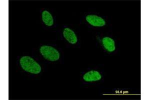 Immunofluorescence of purified MaxPab antibody to TRA2A on HeLa cell. (TRA2A anticorps  (AA 1-282))