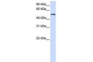 Image no. 1 for anti-Ubiquitin Specific Peptidase 22 (USP22) (AA 216-265) antibody (ABIN6744263) (USP22 anticorps  (AA 216-265))