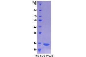 SDS-PAGE analysis of Human CHRNa1 Protein. (CHRNA1 Protéine)