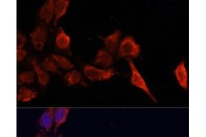 Immunofluorescence analysis of HeLa cells using TIMP1 Polyclonal Antibody at dilution of 1:100. (TIMP1 anticorps)