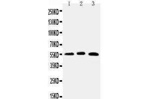 Anti-HNF6 antibody, Western blotting Lane 1: Rat Liver Tissue Lysate Lane 2: Mouse Liver Tissue Lysate Lane 3: HELA Cell Lysate (ONECUT1 anticorps  (N-Term))