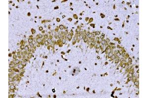 IHC analysis of BRSK1 using anti-BRSK1 antibody (ABIN7600990).