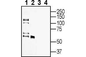 Western blot analysis of rat brain lysates (lanes 1 and 3) and rat spleen membranes (lanes 2 and 4):1-2.