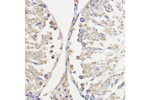 Immunohistochemistry of paraffin-embedded Rat testis using WBSCR27 Rabbit pAb (ABIN7271366) at dilution of 1:50 (40x lens).