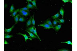 Immunofluorescent analysis of Hela cells using ABIN7168659 at dilution of 1:100 and Alexa Fluor 488-congugated AffiniPure Goat Anti-Rabbit IgG(H+L)