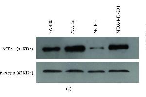 Protein expression of MTA1 by Western Blot analysis. (MTA1 anticorps  (AA 601-715))