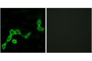 Immunofluorescence analysis of LOVO cells, using KISS1R Antibody. (KISS1R anticorps  (AA 301-350))
