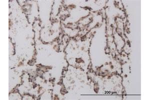 Immunoperoxidase of monoclonal antibody to FOXL1 on formalin-fixed paraffin-embedded human lung. (FOXL1 anticorps  (AA 132-240))