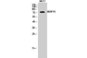 Western Blotting (WB) image for anti-A Kinase (PRKA) Anchor Protein 8 (AKAP8) (Internal Region) antibody (ABIN3173731) (AKAP8 anticorps  (Internal Region))