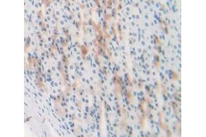 IHC-P analysis of Rat Tissue, with DAB staining. (Complement Factor B anticorps  (AA 34-159))