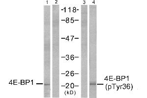 Western blot analysis of extracts from MDA-MB-435 cells, untreated or EGF-treated (200 ng/ml, 30min), using 4E-BP1 (Ab-36) antibody (Line 1 and 2) and 4E-BP1 (phospho-Thr36) antibody (Line 3 and 4). (eIF4EBP1 anticorps  (pThr36))
