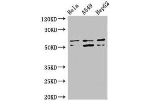 Western Blot Positive WB detected in: Hela whole cell lysate, A549 whole cell lysate, HepG2 whole cell lysate All lanes: COQ8B antibody at 3 μg/mL Secondary Goat polyclonal to rabbit IgG at 1/50000 dilution Predicted band size: 61, 56 kDa Observed band size: 61, 56 kDa (COQ8B anticorps  (AA 10-137))
