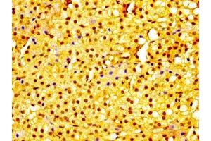 IHC image of ABIN7174989 diluted at 1:300 and staining in paraffin-embedded human adrenal gland tissue performed on a Leica BondTM system.