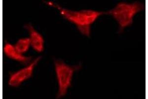 ABIN6276183 staining HeLa by IF/ICC.