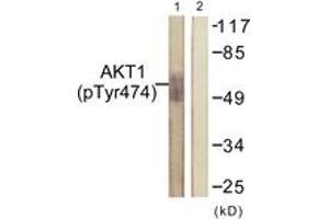 Western blot analysis of extracts from COS7 cells treated with UV 15', using Akt (Phospho-Tyr474) Antibody. (AKT1 anticorps  (pTyr474))