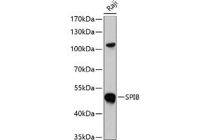 Western blot analysis of extracts of Raji cells, using SPIB antibody  at 1:1000 dilution. (SPIB anticorps  (AA 1-262))