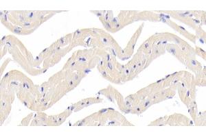 Detection of DLAT in Mouse Cardiac Muscle Tissue using Polyclonal Antibody to Dihydrolipoyl Transacetylase (DLAT)