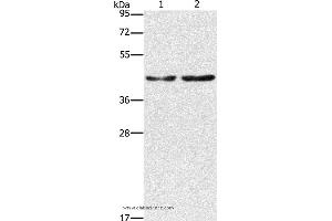 Western blot analysis of Hela and 293T cell, using CBX6 Polyclonal Antibody at dilution of 1:600 (CBX6 anticorps)