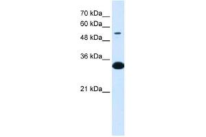 Western Blot showing A1BG antibody used at a concentration of 1-2 ug/ml to detect its target protein.