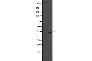 Western blot analysis of OR51M1 expression in SiHa cell line lysates ;,The lane on the left is treated with the antigen-specific peptide. (OR51M1 anticorps  (C-Term))