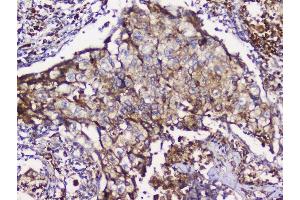 IHC analysis of GRIK1 using anti-GRIK1 antibody (ABIN3042430). (GRIK1 anticorps  (AA 271-450))