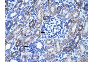 ACCN3 antibody was used for immunohistochemistry at a concentration of 4-8 ug/ml to stain Epithelial cells of renal tubule (arrows) in Human Kidney.