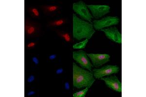 Phospho-EZH2 (Ser311) Antibody staining A549 cells(4h of LPS treatment) by IF/ICC.