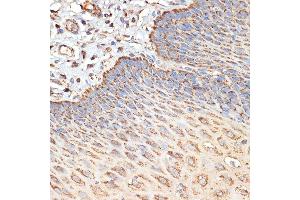 Immunohistochemistry of paraffin-embedded human esophageal using TSC2 Rabbit pAb (ABIN6128542, ABIN6149611, ABIN6149612 and ABIN6213862) at dilution of 1:100 (40x lens). (Tuberin anticorps  (AA 900-1150))