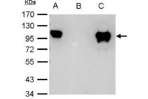 IP Image Glucocorticoid receptor antibody immunoprecipitates Glucocorticoid receptor protein in IP experiments.
