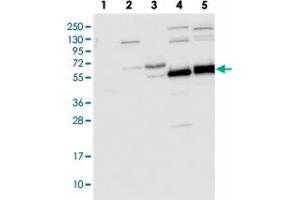 Western blot analysis of Lane 1: RT-4, Lane 2: U-251 MG, Lane 3: Human Plasma, Lane 4: Liver, Lane 5: Tonsil with TRIM7 polyclonal antibody  at 1:250-1:500 dilution. (TRIM7 anticorps)