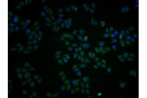 Immunofluorescence staining of Hela cells with ABIN7162877 at 1:100, counter-stained with DAPI. (PCNT anticorps  (AA 250-600))