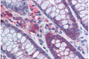 Human Colon: Formalin-Fixed, Paraffin-Embedded (FFPE) (G3BP1 anticorps  (AA 214-303))