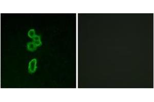 Immunofluorescence analysis of MCF7 cells, using FZD6 Antibody. (FZD6 anticorps  (AA 116-165))
