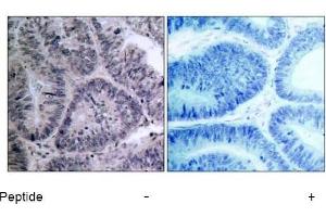 Image no. 1 for anti-conserved Helix-Loop-Helix Ubiquitous Kinase (CHUK) (Thr23) antibody (ABIN197306) (IKK alpha anticorps  (Thr23))