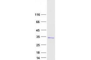 Validation with Western Blot
