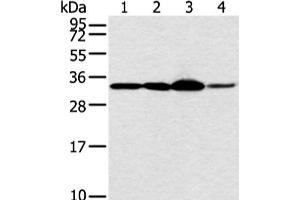 Western blot analysis of Hela and PC3 cell 231 cell and human esophagus cancer tissue using MED6 Polyclonal Antibody at dilution of 1:400 (MED6 anticorps)