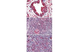 Immunohistochemical staining of formalin-fixed, paraffin-embedded human prostate (A), human thymus (B) and human spleen (C) tissue after heat-induced antigen retrieval. (WNT5B anticorps  (Internal Region))