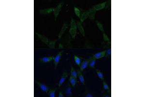 Immunofluorescence analysis of NIH-3T3 cells using ZWINT Polyclonal Antibody (ABIN6128944, ABIN6150552, ABIN6150554 and ABIN6221938) at dilution of 1:100 (40x lens). (ZWINT anticorps  (AA 1-277))
