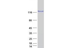 Validation with Western Blot
