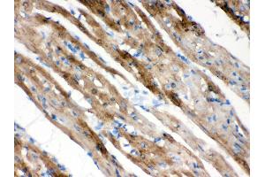 Anti- FXYZ1 Picoband antibody, IHC(P) IHC(P): Rat Cardiac Muscle Tissue (FXYD1 anticorps  (AA 21-92))