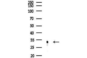 Western blot analysis of lysates from EC304 cells(UV, 30 min treatment), using FHL1 Antibody at 1/1000 dilution.
