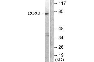 Western blot analysis of extracts from A549 cells, using Cox2 antibody. (COX2 anticorps)